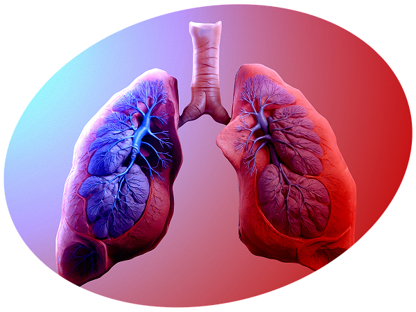 Pulmonary Hypertension Smarter Delivery